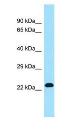 RPL19 antibody Western Blot of 293T.