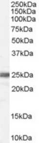 Antibody (0.1 ug/ml) staining of Human Testis lysate (35 ug protein in RIPA buffer). Primary incubation was 1 hour. Detected by chemiluminescence.