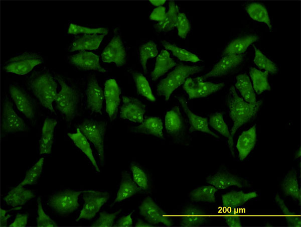 Immunofluorescence of monoclonal antibody to RPL19 on HeLa cell (antibody concentration 10 ug/ml).