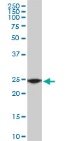 RPL19 monoclonal antibody (M01), clone 3H4. Western blot of RPL19 expression in Raw 264.7.