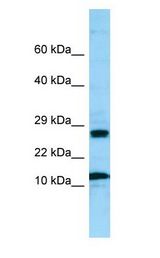 RPL21 antibody Western Blot of MCF7.