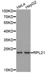 Western blot analysis of extracts of various cell lines, using RPL21 antibody.