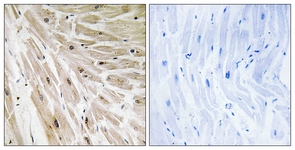IHC of paraffin-embedded human heart tissue, using RPL22 Antibody. The picture on the right is treated with the synthesized peptide.