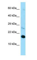 RPL22 / L22 antibody Western Blot of Mouse Heart.