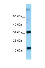 RPL22 antibody LS-C146320 Western blot of Placenta lysate. Antibody concentration 1 ug/ml.