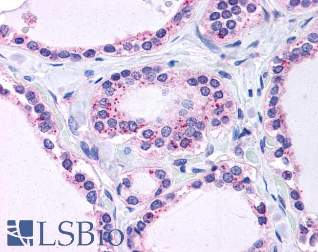 Anti-RPL22 antibody IHC of human thyroid. Immunohistochemistry of formalin-fixed, paraffin-embedded tissue after heat-induced antigen retrieval. Antibody LS-B4941 concentration 3.75 ug/ml.