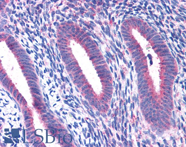 Anti-RPL22 antibody IHC of human uterus. Immunohistochemistry of formalin-fixed, paraffin-embedded tissue after heat-induced antigen retrieval. Antibody LS-B4941 concentration 3.75 ug/ml.