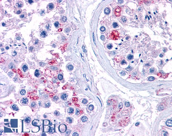 Anti-RPL22 antibody IHC of human testis. Immunohistochemistry of formalin-fixed, paraffin-embedded tissue after heat-induced antigen retrieval. Antibody LS-B4941 concentration 3.75 ug/ml.