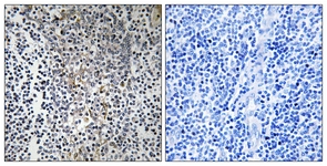IHC of paraffin-embedded human tonsil tissue, using RPL23 Antibody. The sample on the right was incubated with synthetic peptide.