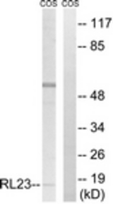Western blot of extracts from COS7 cells, using RPL23 Antibody. The lane on the right was incubated with synthetic peptide.