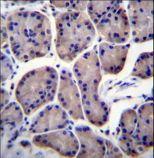 RPL23 Antibody immunohistochemistry of formalin-fixed and paraffin-embedded human stomach tissue followed by peroxidase-conjugated secondary antibody and DAB staining.