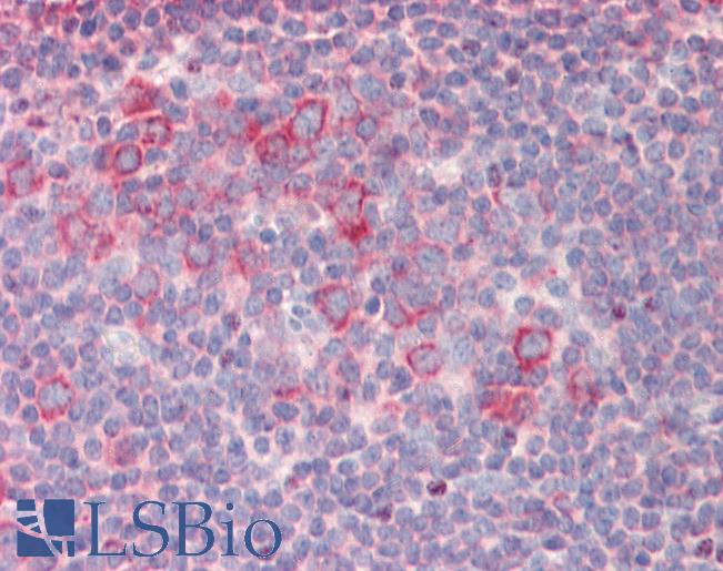 Anti-RPL23 / L23 antibody IHC staining of human tonsil. Immunohistochemistry of formalin-fixed, paraffin-embedded tissue after heat-induced antigen retrieval.