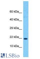 RPL24 antibody Western Blot of Jurkat. Antibody dilution: 1 ug/ml.