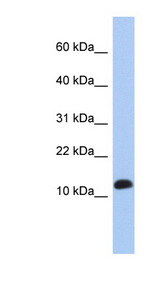 RPL30 antibody LS-C111815 Western blot of Jurkat lysate.