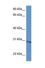 RPL5 antibody LS-C135371 Western blot of Mouse Heart lysate. Antibody concentration 1 ug/ml.