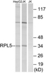 Western blot of extracts from Jurkat/HepG2 cells, using RPL5 Antibody. The lane on the right was incubated with synthetic peptide.