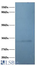 Western blot of 60S ribosomal protein L5 polyclonal Antibody at 2 ug/ml + EC109 whole cell lysate at 20 ug. Secondary: Goat polyclonal to Rabbit IgG at 1:15000 dilution. Predicted band size: 32.7 kDa. Observed band size: 32.7 kDa.