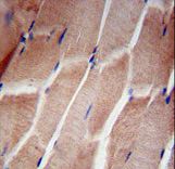 RPL5 Antibody immunohistochemistry of formalin-fixed and paraffin-embedded human skeletal muscle followed by peroxidase-conjugated secondary antibody and DAB staining.