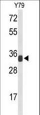 Western blot of RPL5 Antibody in Y79 cell line lysates (35 ug/lane). RPL5 (arrow) was detected using the purified antibody.