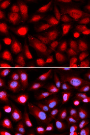 Immunofluorescence analysis of U2OS cell using RPL5 antibody. Blue: DAPI for nuclear staining.