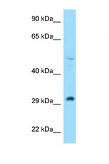 RPL7 antibody LS-C146116 Western blot of H226 Cell lysate. Antibody concentration 1 ug/ml.