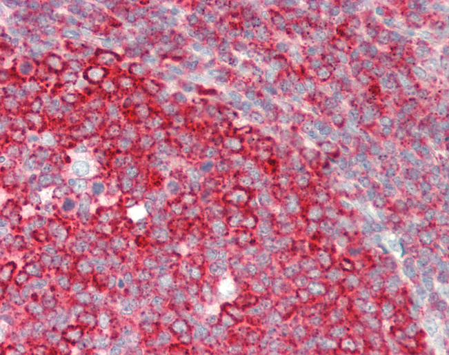 Human Tonsil: Formalin-Fixed, Paraffin-Embedded (FFPE)