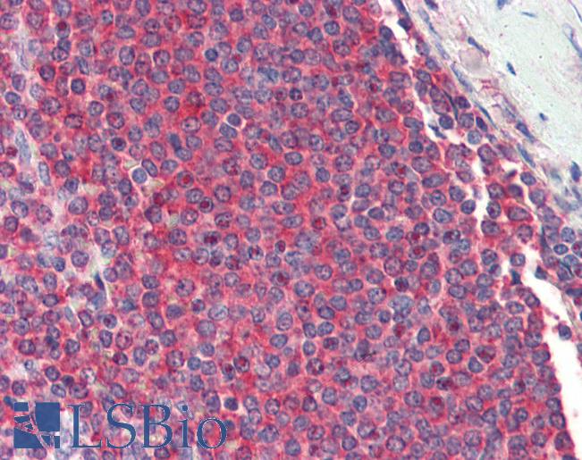 Anti-RPL8 antibody IHC of human spleen. Immunohistochemistry of formalin-fixed, paraffin-embedded tissue after heat-induced antigen retrieval. Antibody LS-B3254 concentration 5 ug/ml.