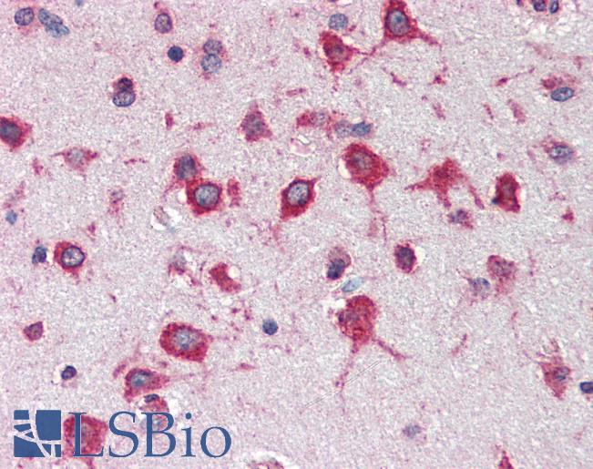 Anti-RPL8 antibody IHC of human brain, cortex. Immunohistochemistry of formalin-fixed, paraffin-embedded tissue after heat-induced antigen retrieval. Antibody LS-B3254 concentration 5 ug/ml.