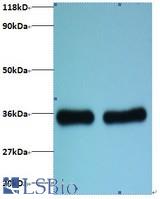 Western blot of 60S ribosomal protein L8 antibody at 2 ug/ml. Lane 1: EC109 whole cell lysate. Lane 2: 293T whole cell lysate. Predicted band size: 28 kDa. Observed band size: 35 kDa.