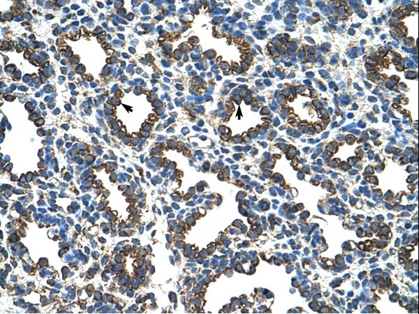 RPL8 antibody LS-C31781 was used in IHC to stain formalin-fixed, paraffin-embedded human lung.