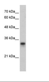 HepG2 Cell Lysate