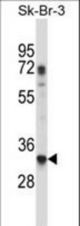 RPL8 Antibody western blot of SK-BR-3 cell line lysates (35 ug/lane). The RPL8 antibody detected the RPL8 protein (arrow).