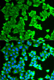 Immunofluorescence analysis of HeLa cell using RPLP0 antibody. Blue: DAPI for nuclear staining.