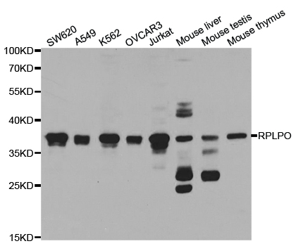 Western blot analysis of extracts of various cell lines, using RPLP0 antibody.