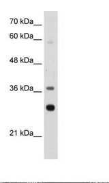 Jurkat Cell Lysate