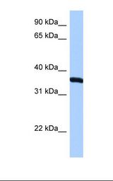HepG2 cell lysate. Antibody concentration: 0.5 ug/ml. Gel concentration: 12%.