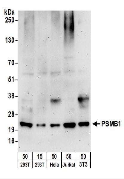 Detection of Human and Mouse PSMB1 by Western Blot. Samples: Whole cell lysate from 293T (15 and 50 ug), HeLa (50 ug), Jurkat (50 ug), and mouse NIH3T3 (50 ug) cells. Antibodies: Affinity purified rabbit anti-PSMB1 antibody used for WB at 0.1 ug/ml. Detection: Chemiluminescence with an exposure time of 3 minutes.