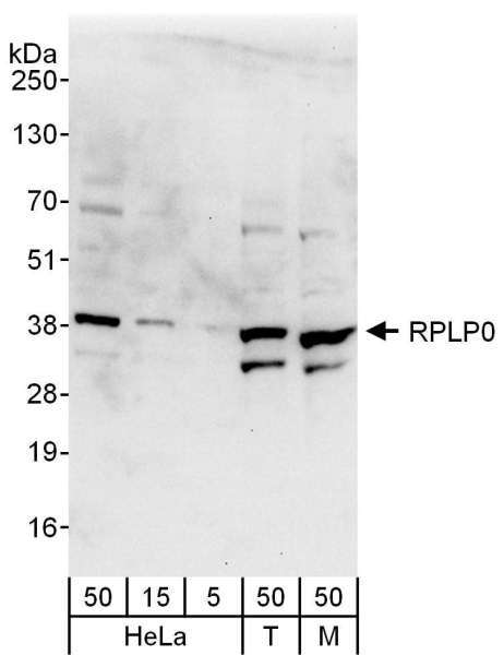 Detection of Human and Mouse RPLP0 by Western Blot. Samples: Whole cell lysate from HeLa (5, 15 and 50 ug for WB), 293T (T; 50 ug), and mouse NIH3T3 (M; 50 ug) cells. Antibodies: Affinity purified rabbit anti-RPLP0 antibody used for WB at 0.1 ug/ml. Detection: Chemiluminescence with an exposure time of 10 seconds.