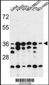 Western blot of RPLP0 Antibody (Center)) in Jurkat, A2058, A375, MDA-MB231, Y79, NCI-H460 cell line lysates (35 ug/lane). RPLP0 (arrow) was detected using the purified Pab.