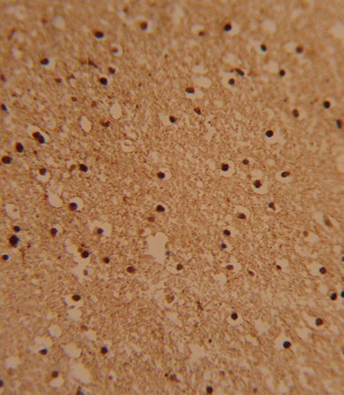 Formalin-fixed and paraffin-embedded human brain tissue reacted with PSMB1 Antibody , which was peroxidase-conjugated to the secondary antibody, followed by DAB staining. This data demonstrates the use of this antibody for immunohistochemistry; clinical relevance has not been evaluated.