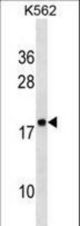 RPLP2 Antibody western blot of K562 cell line lysates (35 ug/lane). The RPLP2 antibody detected the RPLP2 protein (arrow).