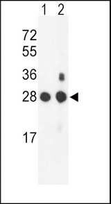 Western blot of PSMB1 Antibody in mouse NIH-3T3 cell line(lane 1) and mouse bladder tissue(lane 2) lysates (35 ug/lane). PSMB1 (arrow) was detected using the purified antibody.