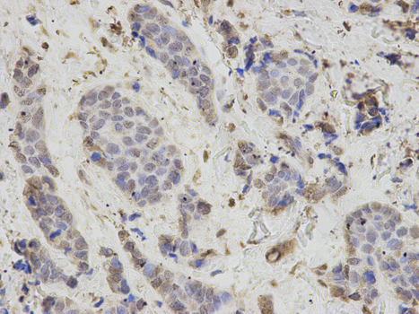 Immunohistochemistry of paraffin-embedded rat testis using PSMB1 antibody at dilution of 1:200 (400x lens).
