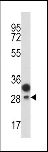 Western blot of CD201 antibody in T47D cell line lysates (35 ug/lane). CD201 (arrow) was detected using the purified antibody.