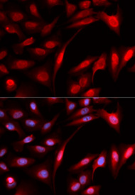 Immunofluorescence analysis of U20S cell using PSMB1 antibody. Blue: DAPI for nuclear staining.