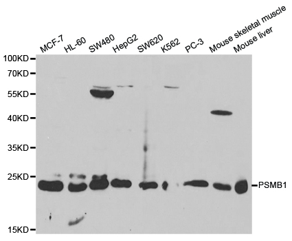 Western blot analysis of extracts of various cell lines, using PSMB1 antibody.
