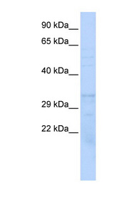 PSMB1 antibody LS-C111922 Western blot of 721_B cell lysate.