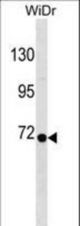 RPN1 Antibody western blot of WiDr cell line lysates (35 ug/lane). The RPN1 antibody detected the RPN1 protein (arrow).