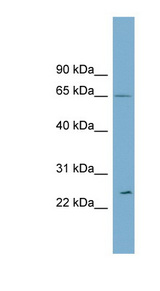 RPN2 antibody LS-C111027 Western blot of THP-1 cell lysate.