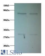 Western blot of Proteasome subunit beta 1 antibody at 2 ug/ml. Lane 1: EC109 whole cell lysate. Lane 2: 293T whole cell lysate. Secondary: Goat polyclonal to Rabbit IgG at 1:15000 dilution. Predicted band size: 26.4 kDa. Observed band size: 30 kDa Additional bands at: 75 kDa. We are unsure as to the identity of this extra band.